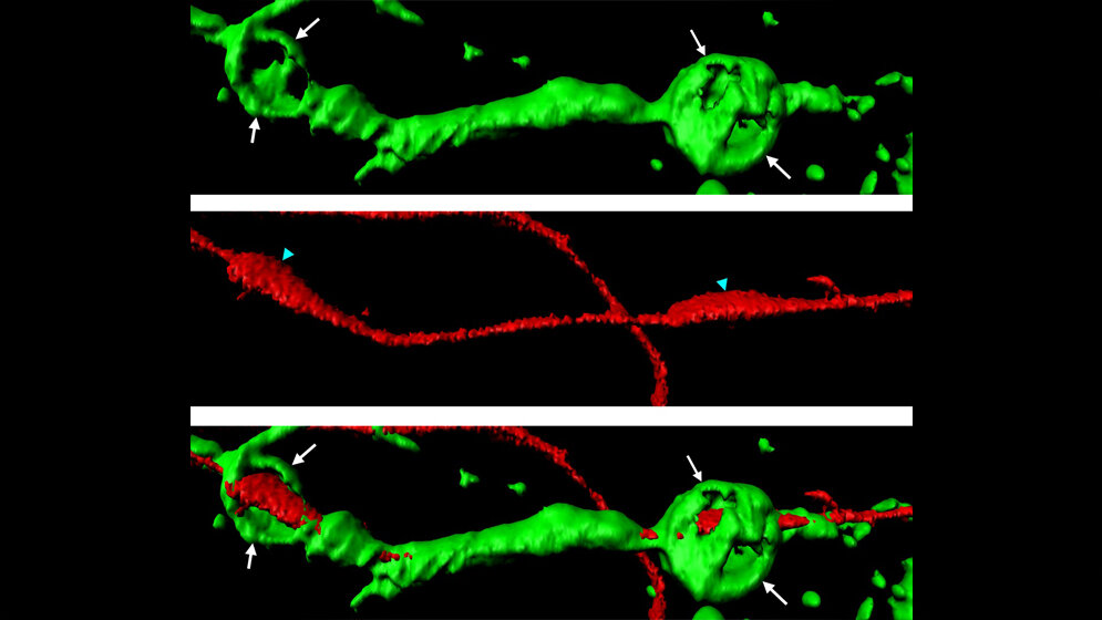 Aktin_Sphaeren_gruen_die_ein_geschnittenes_Axon_rot_umgeben_Abb_Adrien_Vaquie_Cell_Reports.jpg Aktin-Sphären, die ein geschnittenes Axon umgeben
