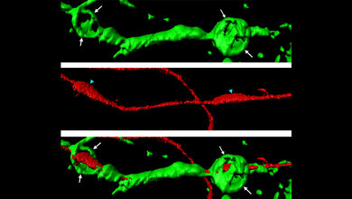 Aktin_Sphaeren_gruen_die_ein_geschnittenes_Axon_rot_umgeben_Abb_Adrien_Vaquie_Cell_Reports.jpg Aktin-Sphären, die ein geschnittenes Axon umgeben