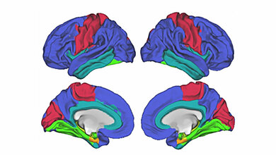 LMU_Forscher_entschluesseln_Mechanismus_eines_genetischen_Risikotyps_der_Alzheimer_Krankheit_LMU.jpg Risikogen der Alzheimer Krankheit