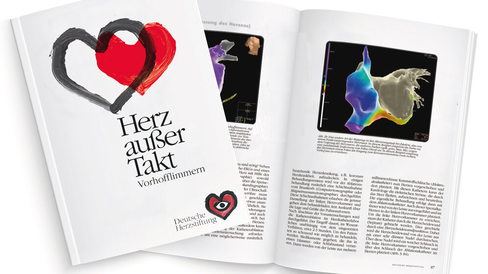 Deutsche_Herzstiftung_Jan_Neuffer_Collage_C_Marx.jpg „Herz außer Takt: Vorhofflimmern“