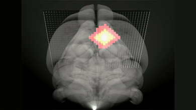 Neue_MRT_methode_Ischaemie_MPI_fuer_biologische_Kybernetik.jpg neue MRT Methode bei Ischämie