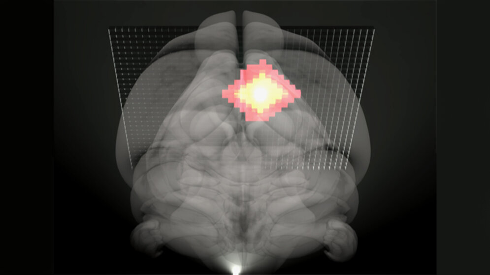 Neue_MRT_methode_Ischaemie_MPI_fuer_biologische_Kybernetik.jpg neue MRT Methode bei Ischämie