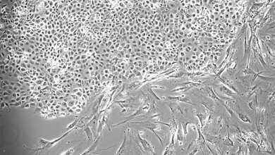 Isolierte_Zellen_aus_einem_Pleuraerguss_Quelle_Helmholtz_Zentrum_Muenchen.jpg Isolierte Zellen aus einem Pleuraerguss