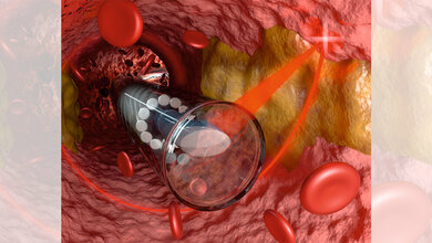 Miniaturoptik_im_Inneren_einer_Ader_Florian_Sterl_Sterltech_Optics.jpg Miniaturoptik