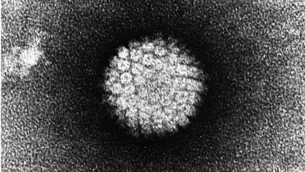 Elektronenmikroskopische_Aufnahme_eines_Humanen_Papillomvirus_Wikimedia_Commons.jpg Elektronenmikroskopische Aufnahme eines Humanen Papillomvirus.