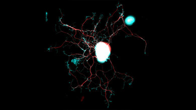 Nervenzelle_aus_den_dorsalen_Wurzelganglien_unter_dem_Mikroskop_DZNE_Barbara_Schaffran.jpg Nervenzelle