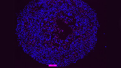 Im_Inneren_des_Spheroids_sterben_Zellen_am_programmierten_Zelltod_Apoptose_pink_Quelle_DKFZ_Almut_Schulze.jpg programmierter Zelltod