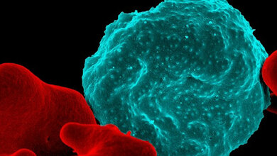 Red_blood_cell_infected_with_malaria_parasites_NIAID_RML.jpg Rotes Blutkörperchen, das mit Malaria infiziert ist (blau).
