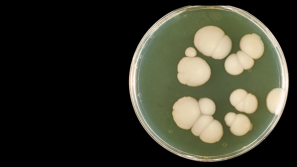 Mikrobiologie Die Rolle der Sprosspilze in der Medizin (Teil 1)