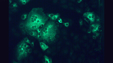 Affennierenzellen_die_mit_dem_MERS_Coronavirus_gruen_infiziert_sind_Foto_Mueller_Charite.jpg Affennierenzellen, die mit dem MERS-Coronavirus (grün) infiziert sind