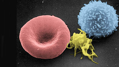 Blutzellen_NCI_Frederick_Public_domain_via_Wikimedia_Commons.jpg Erythrozyt, aktivierter Thrombozyt und Leukozyt