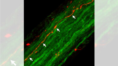 Fasern_des_Nervus_Vagus_Quelle_DZNE_Ayse_Ulusoy.jpg Fasern des Nervus Vagus