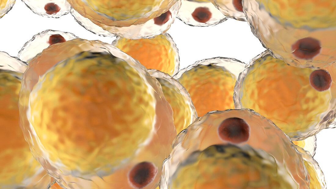 Fettzellen.jpg Vergrößerte Fettzellen können Stoffwechselerkrankungen verursachen.