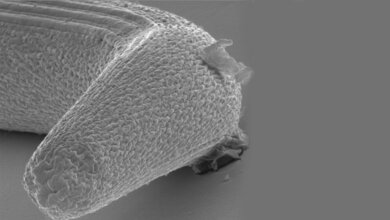 Vorderende_einer_infektioesen_Strongyloides_Larve_Adrian_Streit.jpg Strongyloides-Larve