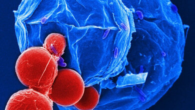 REM_Aufnahme_von_Vitrella_brassicaformis_Manfred_Rohde_HZI.jpg REM-Aufnahme von Vitrella brassicaformis