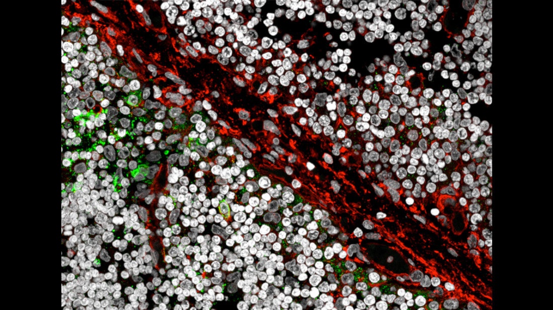 B_Zellen_gruen_in_Thymusgewebe.jpg B-Zellen (grün) in Thymusgewebe