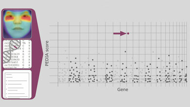 Mit_Kuenstlicher_Intelligenz_KI_zur_Diagnose_seltener_Erbkrankheiten_Foto_Tori_Pantel.jpg Mit Künstlicher Intelligenz zur Diagnose seltener Erbkrankheiten