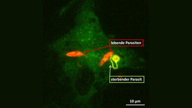 Leishmanien_infizierter_Makrophage_Quelle_Paul_Ehrlich_Institut.jpg Leishmanien infizierter Makrophage