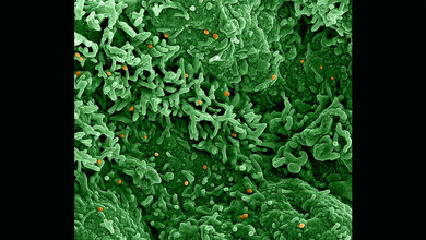 Monkeypox_virus_NIAID_creativecommons_org_licenses_by_2_0.jpg Affenpockenvirus