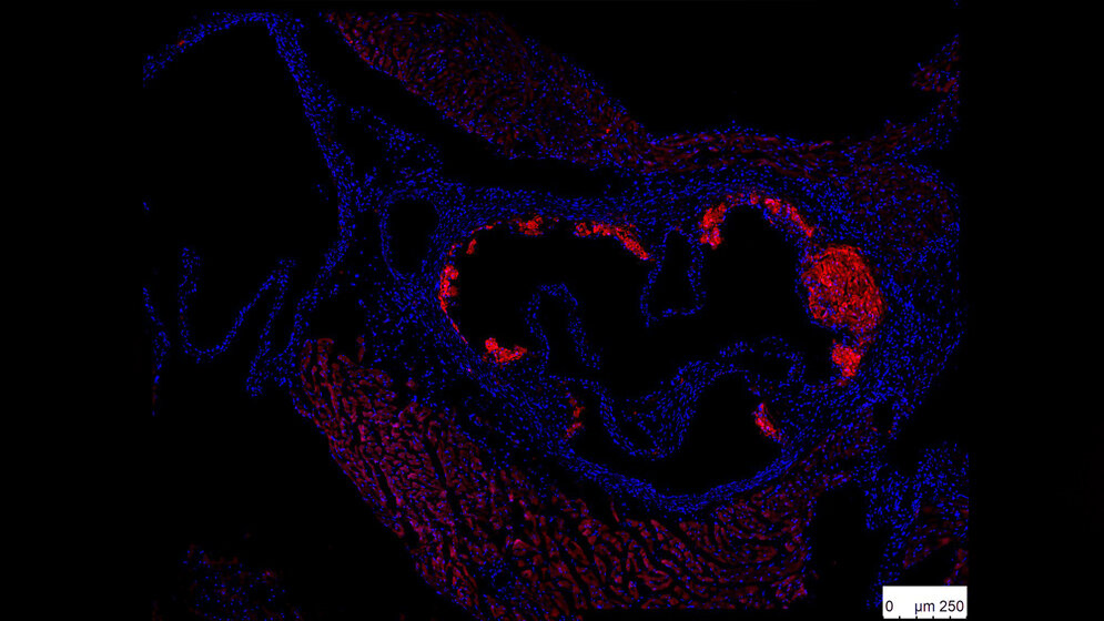 Immunofluoreszenzfaerbung_von_atherosklerotischen_Plaques_Tsiantoulas_et_al_Circulation.jpg Immunofluoreszenzfärbung von atherosklerotischen Plaques