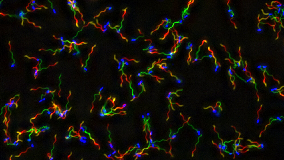 Salmonellen_mit_angefaerbten_Flagellen_HZI_Renault_et_al.jpg Salmonellen mit angefärbten Flagellen