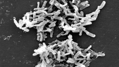 Clostridium_difficile_von_einer_Stuhlprobe_CDC_Lois_S_Wiggs_public_domain.jpg Clostridium difficile (von einer Stuhlprobe)