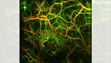 Neue_bildgebende_Methoden_erlauben_fruehere_Diagnose_von_Tumorerkrankungen_Murad_Omar_Helmholtz_Zentrum_Muenchen.jpg frühere Diagnose von Tumorerkrankungen