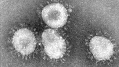 coronavirus_CDC_Dr_Fred_Murphy_15082016.jpg Coronavirus