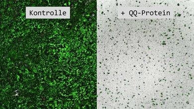 Biofilme_Nancy_Weiland_Braeuer_01082016.jpg Klebsiella oxytoca