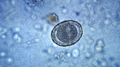 Labordiagnostik Nachweis intestinaler Würmer mittels koproskopischer Untersuchungen