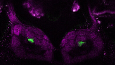 Fluoreszenzmikroskopische_Aufnahme_des_Antennallobus_Veit_Grabe_MPI_fuer_chemische_Oekologie.jpg Fluoreszenzmikroskopische Aufnahme des Antennallobus