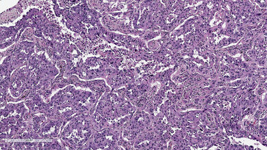 Molekularbiologie Optimierung und Validierung von PDL1-Färbeprotokollen am Beispiel E1L3N