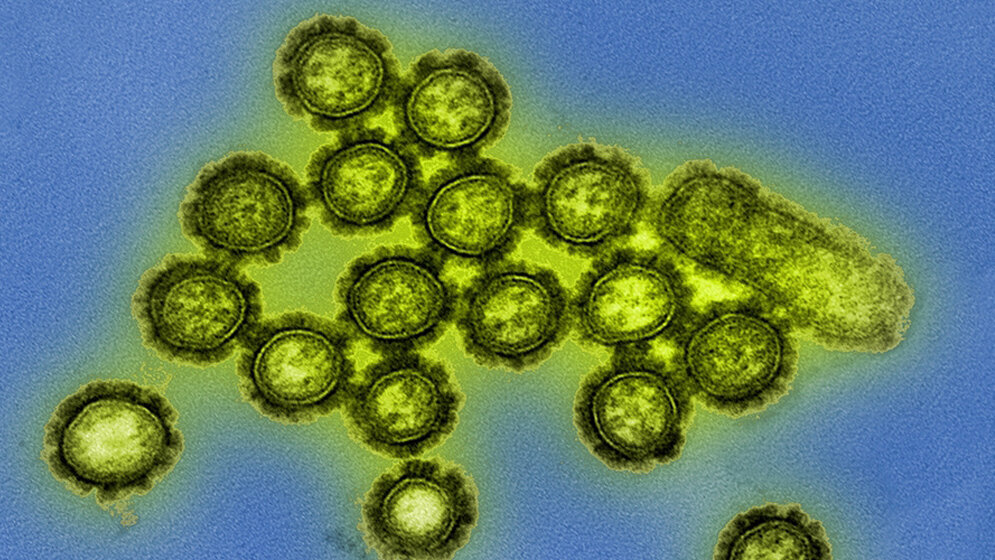 Viruspartikel_des_Grippeerregers_H1N1_NIAID_CC-BY_2_0.jpg Viruspartikel des Grippeerregers H1/N1