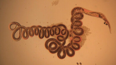 Nematode_Heligmosomoides_polygyrus_By_D_Davesne_Own_work_CC_BY_SA_3_0.jpg Nematode Heligmosomoides polygyrus