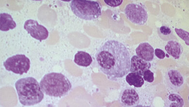 Veranstaltungen 7. Offenburger Hämatologietage