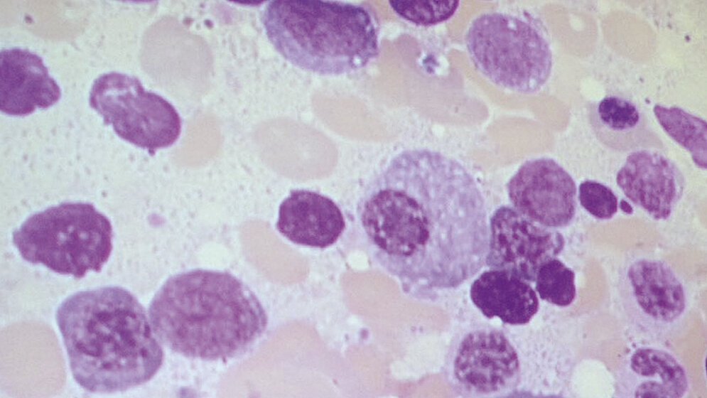 Veranstaltungen 7. Offenburger Hämatologietage