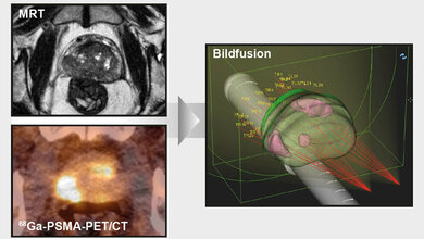 unterschiedlichste_Bildgebungsmethoden_mit_Echtzeit_Ultraschallbild_fusioniert_Universitaetsklinikum_Freiburg.jpg Bildgebungsmethoden mit Echtzeit-Ultraschallbild fusioniert