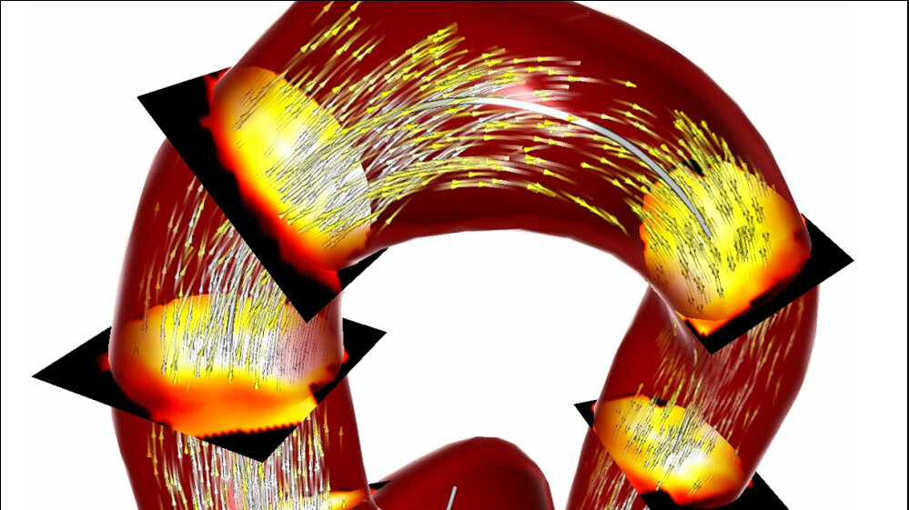 Analyse_Blutflussgeschwindigkeiten_im_Aortenbogen_Quelle_Monique_Meuschke_Arbeitsgruppe_Visualisierung_02052016.jpg Analyse der Blutflussgeschwindigkeiten