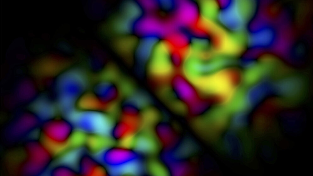 Darstellung_von_gestreutem_Licht_Benjamin_Judkewitz_Charite.jpg Darstellung von gestreutem Licht.