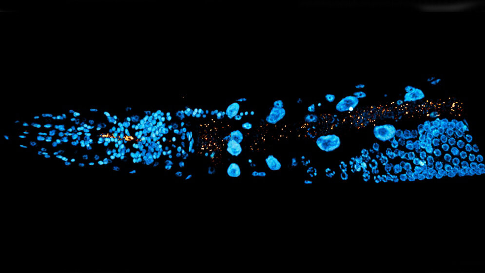 Fadenwurm_Bakterien_orange_eingefaerbt_Abbildung_Philipp_Dirksen_13052016.jpg Fadenwurm