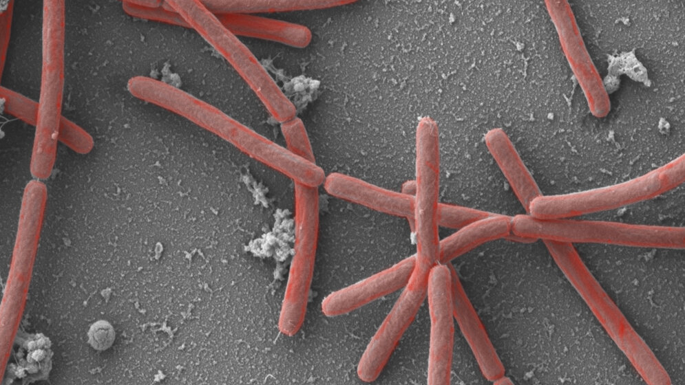 Die_Mikrobe_des_Jahres_2021_Methanothermobacter_Andreas_Klingl__CC_BY_4_0.jpg Methanothermobacter