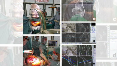 Dreidimensionale_Roentgenbildgebung_Prof_Burgkart.jpg Dreidimensionale Röntgenbildgebung