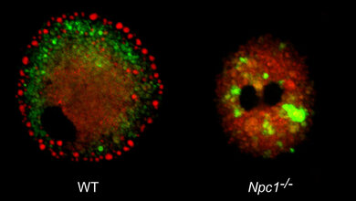 Mikroglia_DZNE.jpg Mikroskopischer Blick auf Mikroglia