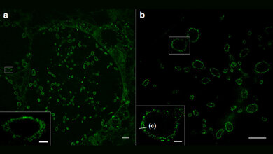 Sphingolipid_Expansionsmikroskopie_von_zehnfach_expandierten_Zellen_AG_Markus_Sauer_Uni_Wuerzburg.jpg Sphingolipid-Expansionsmikroskopie (ExM)