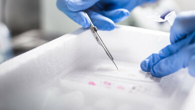 Aufarbeitung_des_Tumorgewebes_für_die_Sequenzierungen_charite.jpg Aufarbeitung des Tumorgewebes