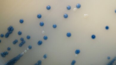 MRSA_on_Brilliance_MRSA_Chromogenic_Agar_ByNathan_R_CC_BY_2_0_17052016.jpg MRSA