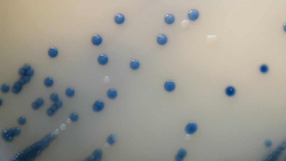 MRSA_on_Brilliance_MRSA_Chromogenic_Agar_ByNathan_R_CC_BY_2_0_17052016.jpg Problemkeime