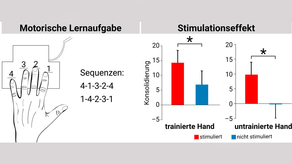 Stimulation_des_Gehirns_MPI_CBS_Jost_Julian_Rumpf.jpg Stimulation hilft