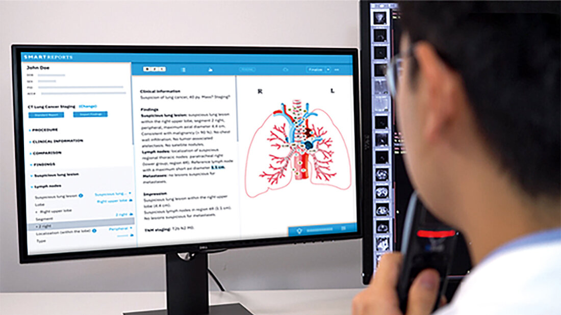 Smart Reporting hat Finanzierungsrunde abgeschlossen Foto der Software Smart Reporting