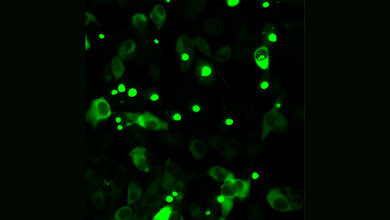 Huntington_Y_Richter.jpg Humane Zellen, die fluoreszenz-markiertes mutiertes Huntingtin herstellen.